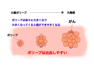 検査方法